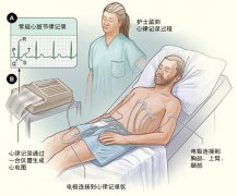 冠心病需要做哪些檢查？